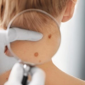 Dermatología